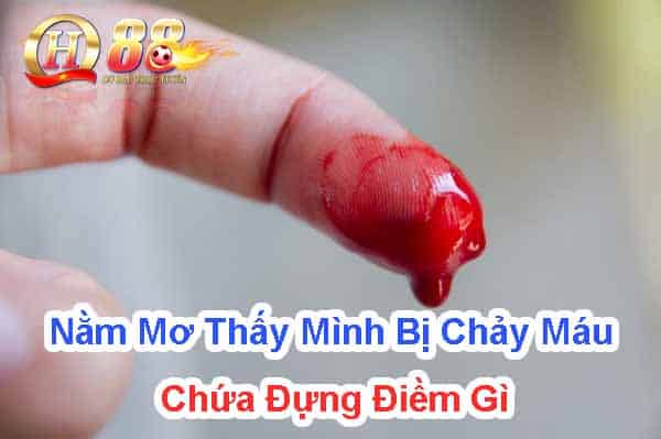 Nằm mơ thấy mình bị chảy máu chứa đựng điềm gì?