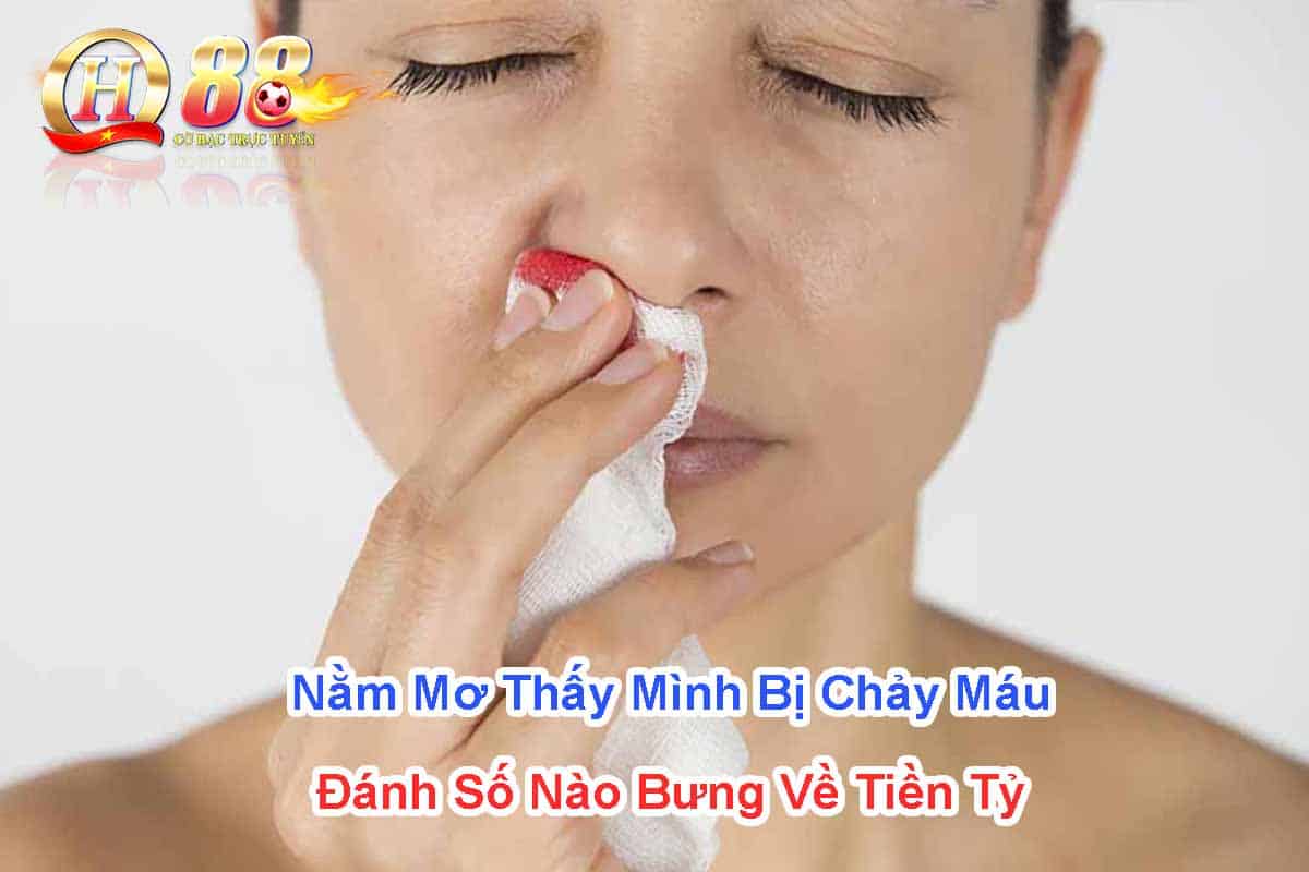 nam-mo-thay-minh-bi-chay-mau-danh-so-nao-bung-ve-tien-ty