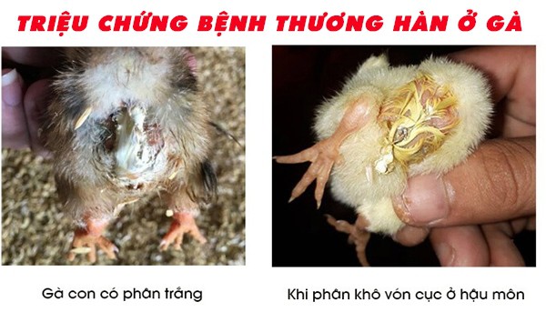 benh-thuong-han-o-ga-benh-truyen-nhiem-cap-tinh-nguy-hiem